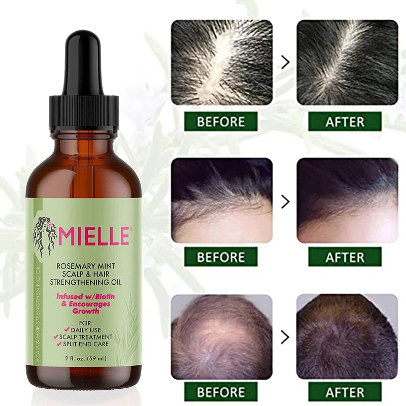 Mielle Organics Rosmarinöl