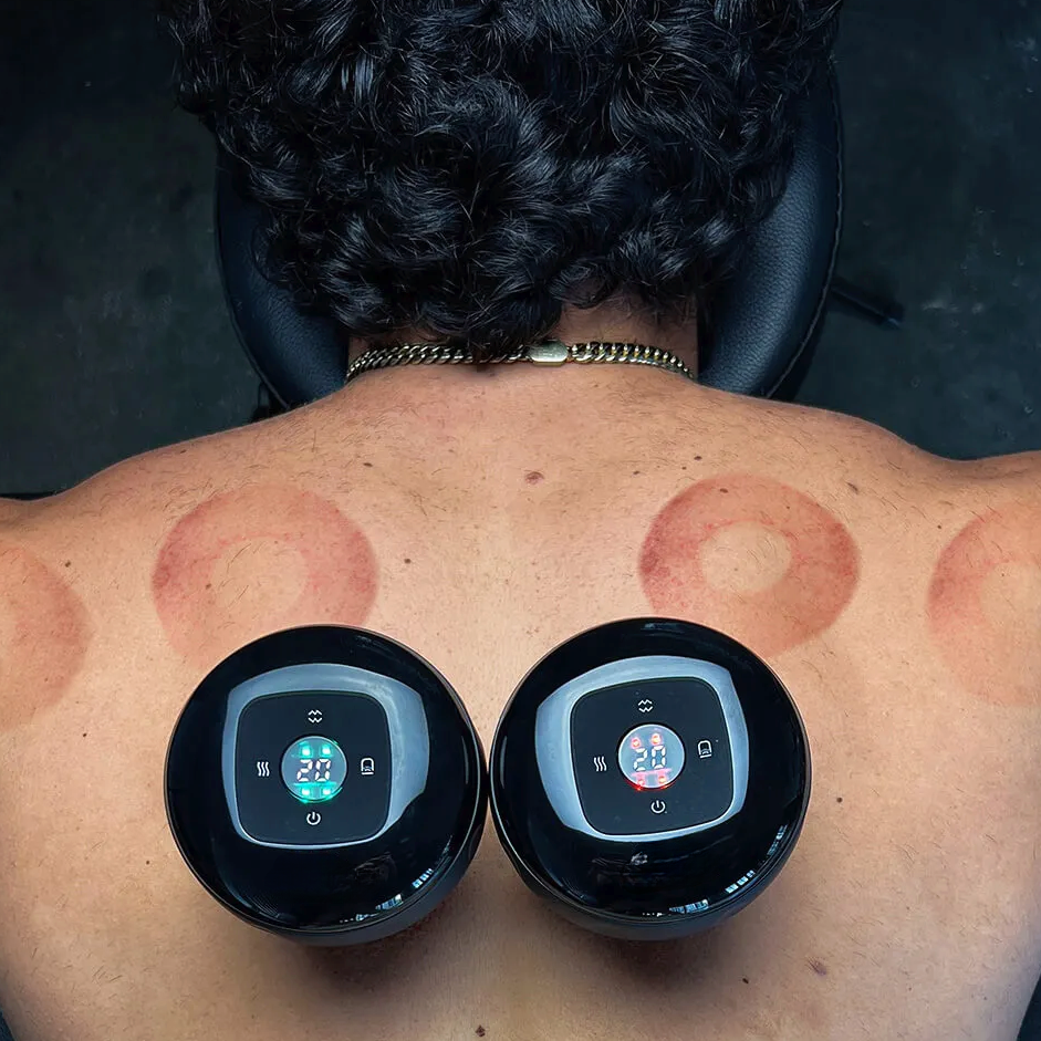 RelaxCupp - Schröpfmassagegerät mit Wärme- und Rotlichttherapie